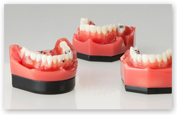 GO DENT® - Modelle