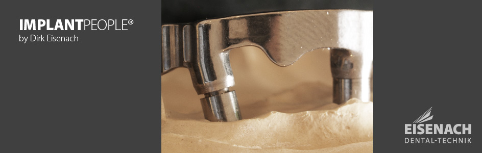 <strong>IMPLANT</strong>PEOPLE<sup>®</sup>
