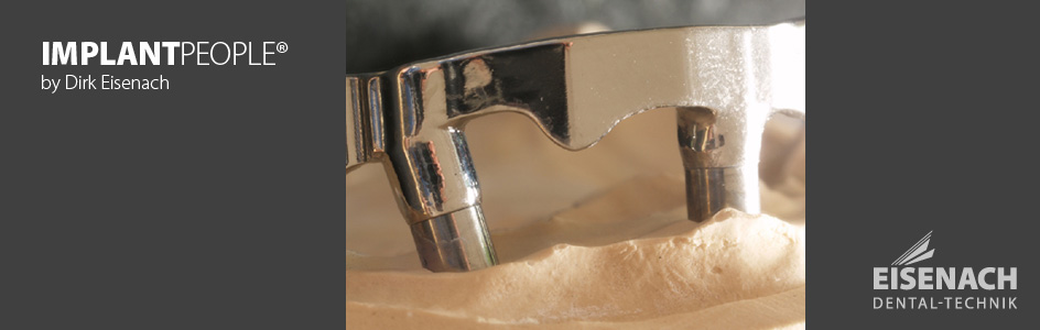<strong>IMPLANT</strong>PEOPLE<sup>®</sup>