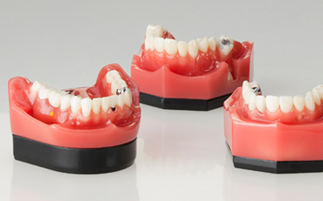 GO DENT® - Modelle